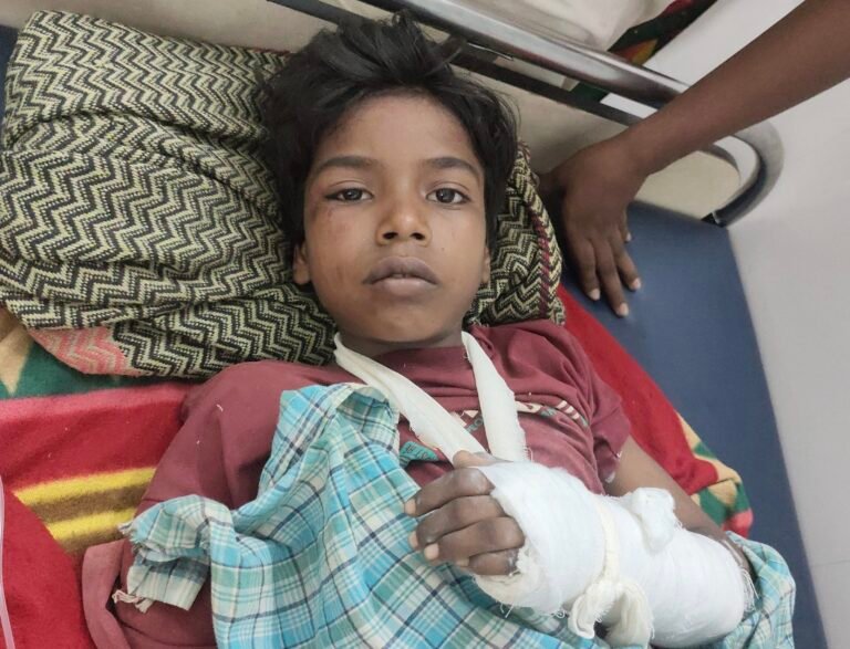 हादसा: आम के पेड़ से गिरकर 12 वर्षीय बालक गंभीर रूप से घायल; सदर अस्पताल से रिम्स रांची रेफर