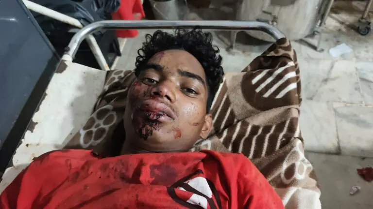 लोहरदगा:सेन्हा मोटरसाइकिल दुर्घटना में झखरा जितिया टोली का युवक गंभीर रूप से घायल, सदर अस्पताल में इलाज जारी